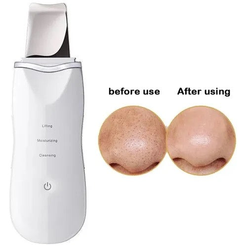 Limpiador Ultrasonico Facial