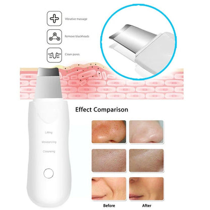 Limpiador Ultrasonico Facial