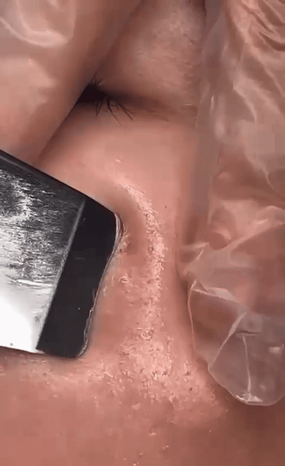 UltraScrub - Espátula Ultrasónica Facial